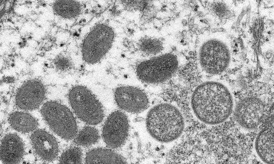 美专家称猴痘病毒将更具传染性，这种病毒会如何影响人体机能？