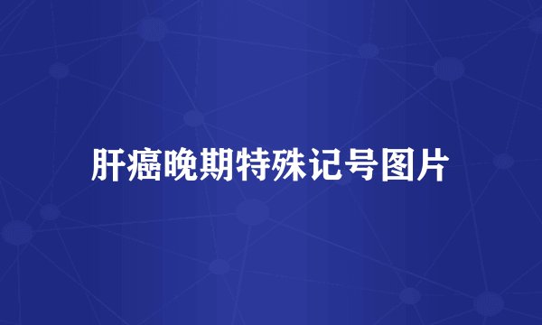 肝癌晚期特殊记号图片