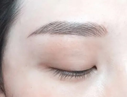 激光洗眉一般要多少钱