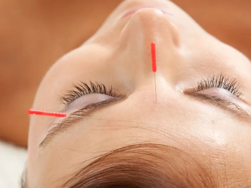 嘴角有法令纹怎么办