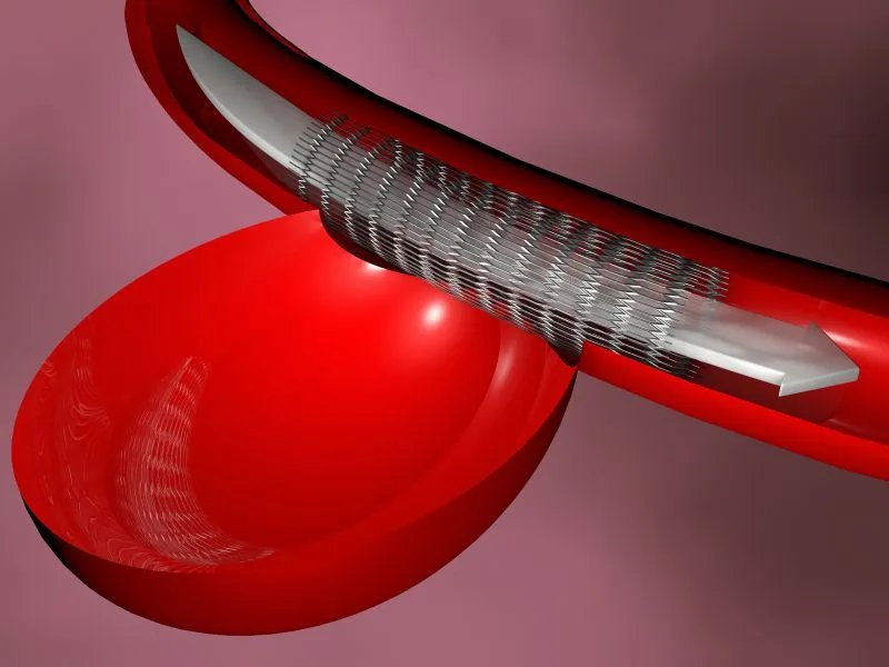 手足麻木怎么办