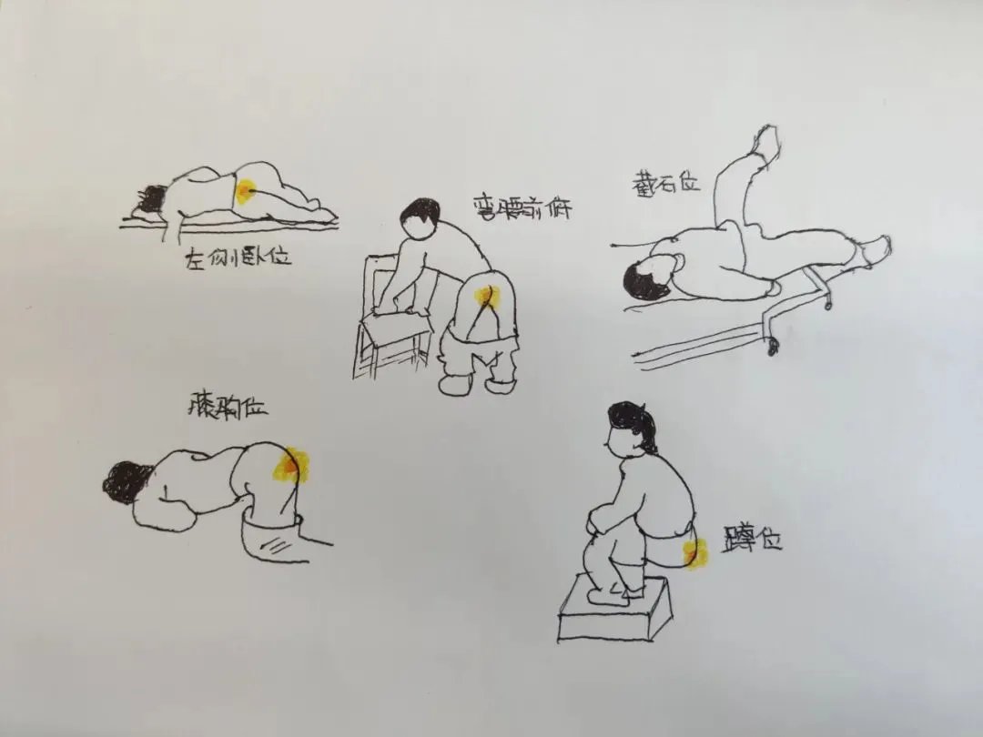 被“爆菊”是一种什么样的体验?别划走——