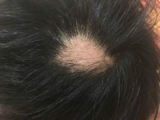 防脱发洗发水哪个好?