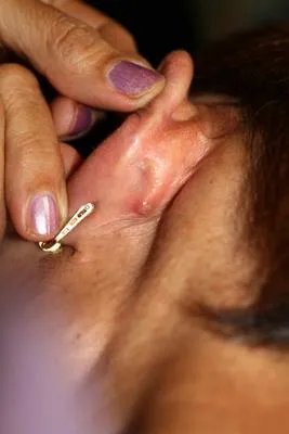 耳石症是怎么造成的 揭晓造成耳石症的3个原因