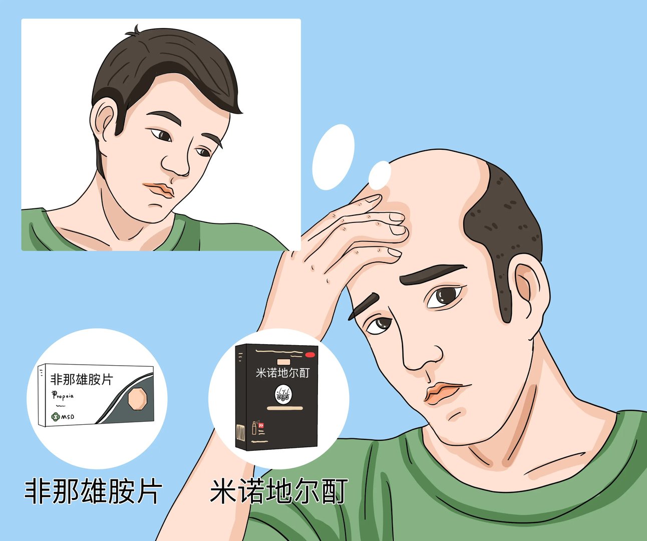 治脱发的药