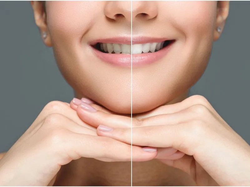 美白针有哪些副作用