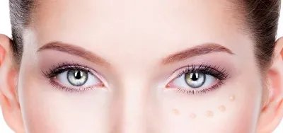 切眼袋怎么护理