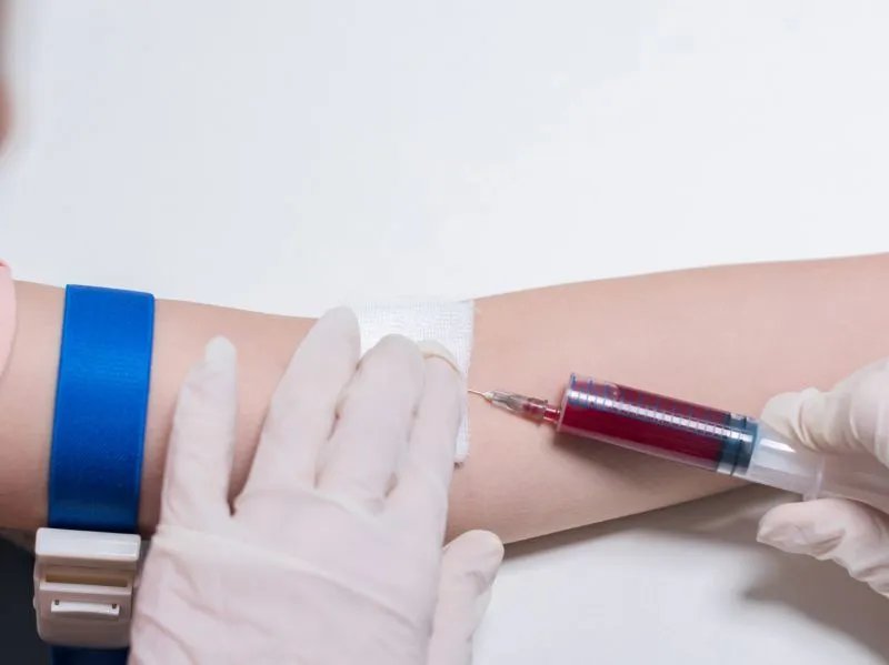 使用气压止血带的注意事项