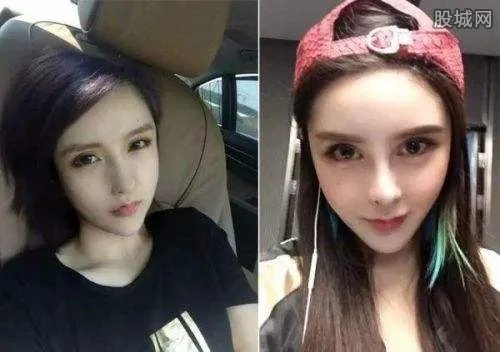 沉珂自残照片死亡真相 曾因抑郁企图告别人世