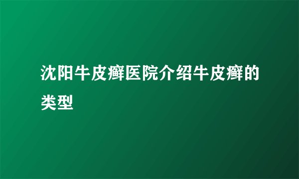 沈阳牛皮癣医院介绍牛皮癣的类型