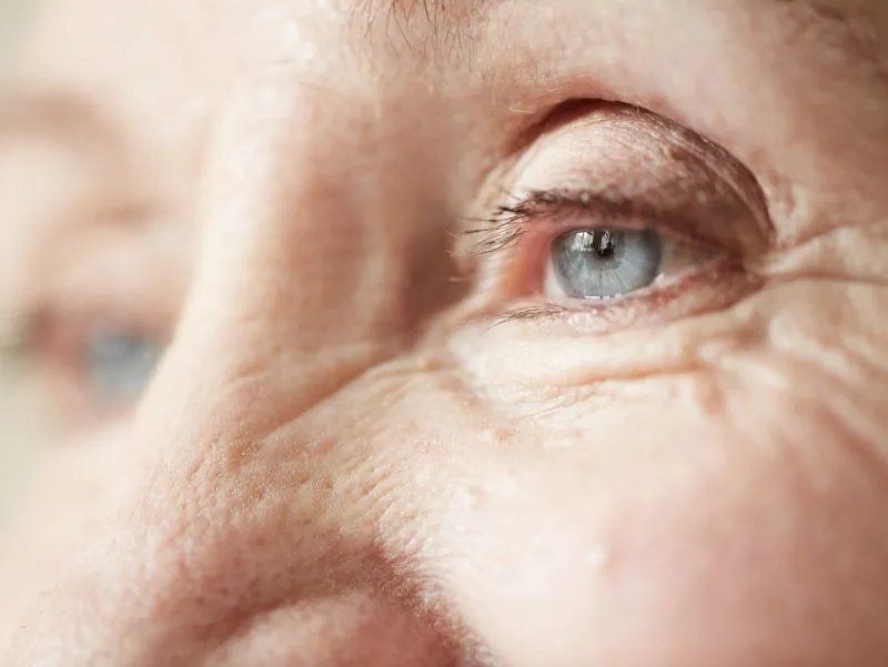 白眼珠发黄怎么办