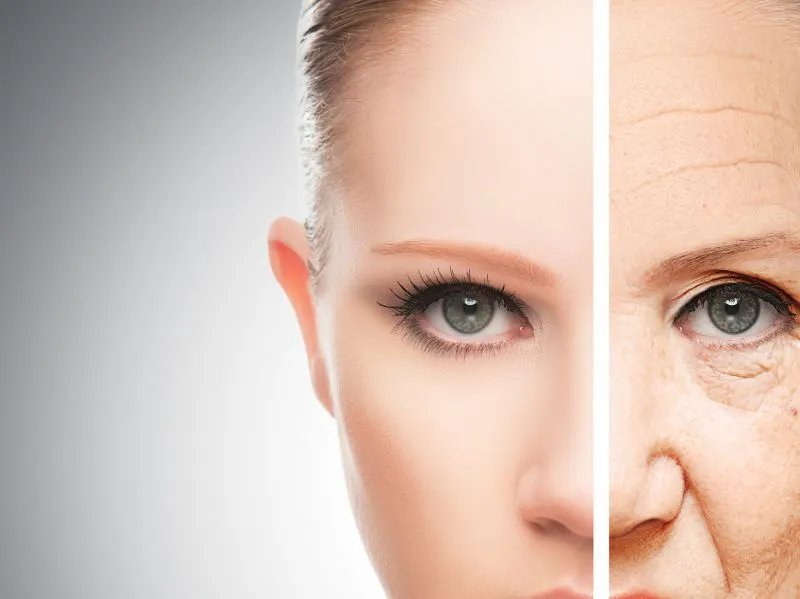 皮肤细纹的形成原因