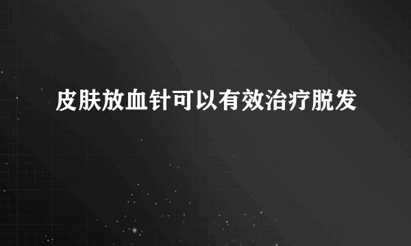 皮肤放血针可以有效治疗脱发