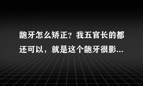 龅牙怎么矫正？我五官长的都还可以，就是这个龅牙很影响我的容貌，同学从小就叫我龅牙苏，我想矫正我的牙齿！