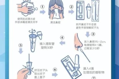 抗原抗体检测试剂盒怎么用
