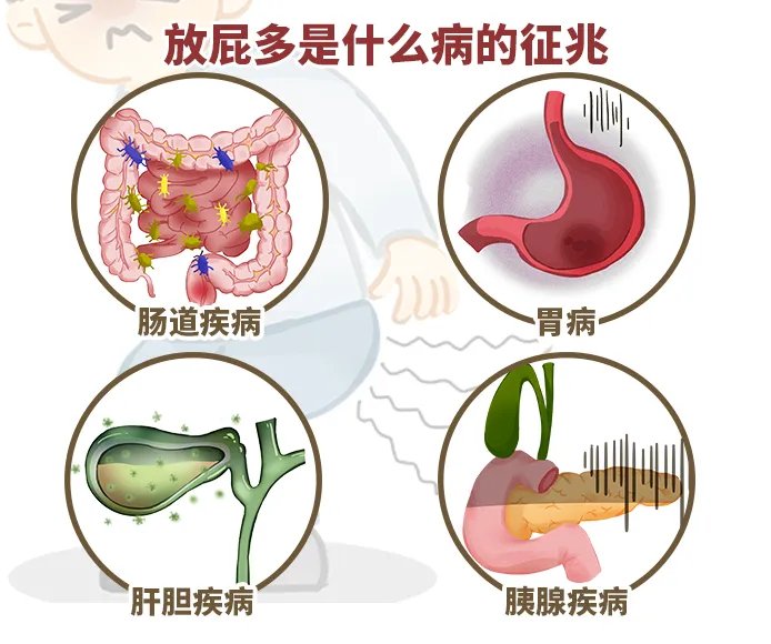 放屁多是什么病的征兆