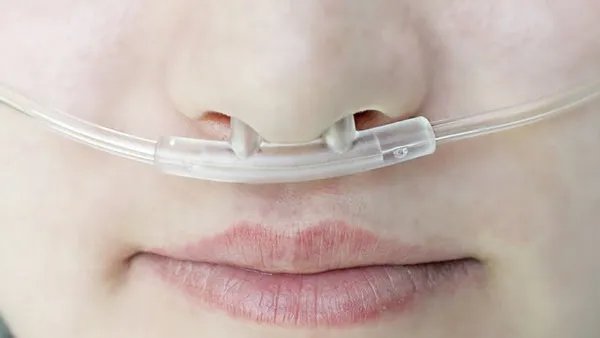 轻度煤气中毒怎么缓解