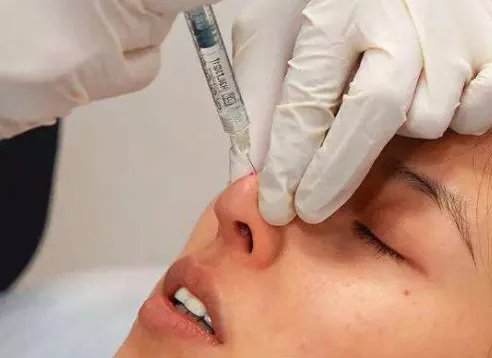 玻尿酸瑞蓝牌子怎么样