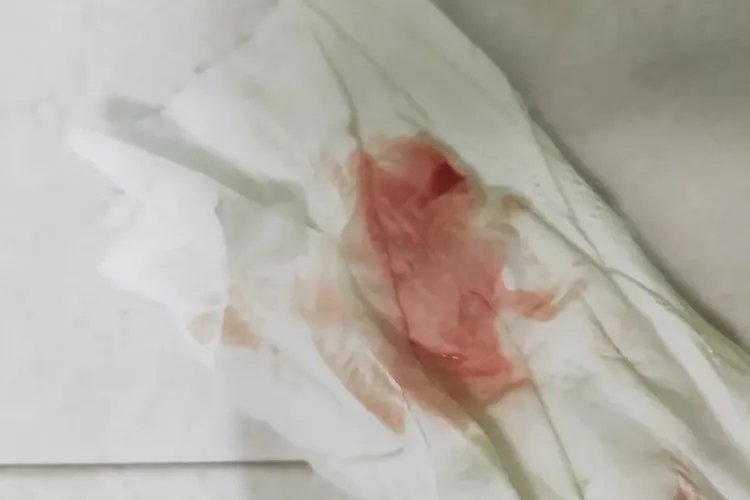 着床出血的量和颜色的照片