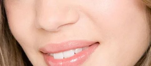 注射瘦脸大概多少钱