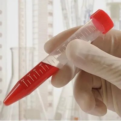 尿血是什么原因