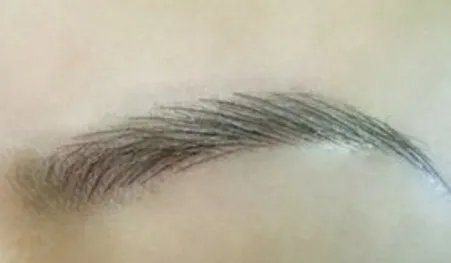 提眉术贵吗