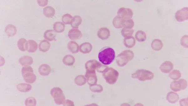 外伤性癫痫的原因