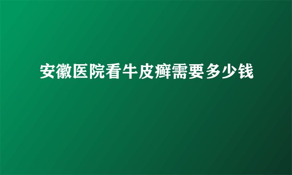 安徽医院看牛皮癣需要多少钱