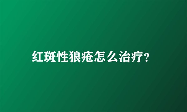 红斑性狼疮怎么治疗？