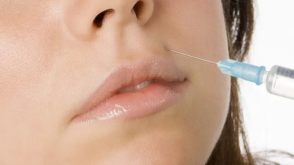 毛孔粗大怎么治