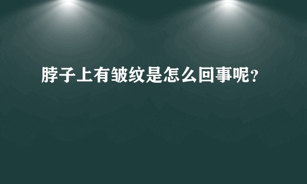 脖子上有皱纹是怎么回事呢?