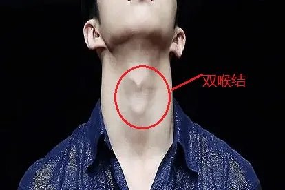 双喉结和单喉结的区别图片
