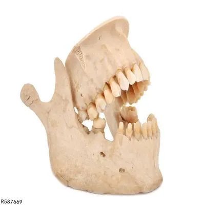 固定假牙价格是多少 固定假牙价格受三因素影响