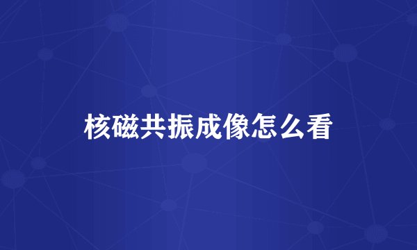核磁共振成像怎么看