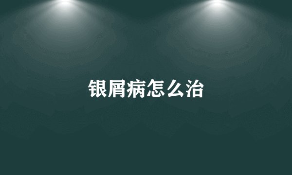 银屑病怎么治