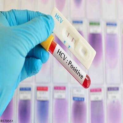 丙肝窗口期的症状有哪些