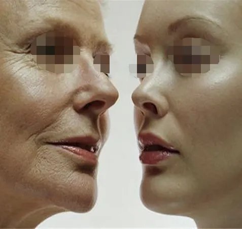 韩式整容手术有哪些优点