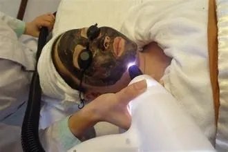 黑脸娃娃多久做一次好