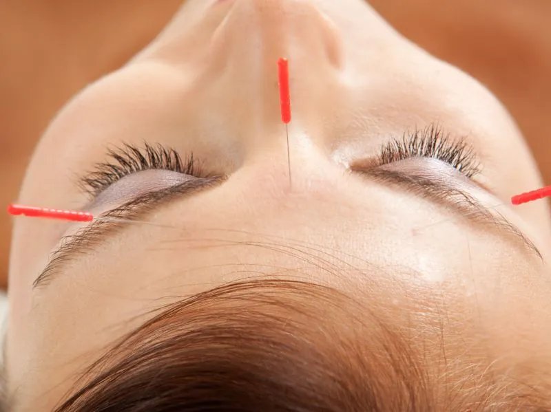 注射美容材料有哪些