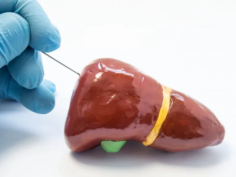 甲型肝炎病毒抗体是什么