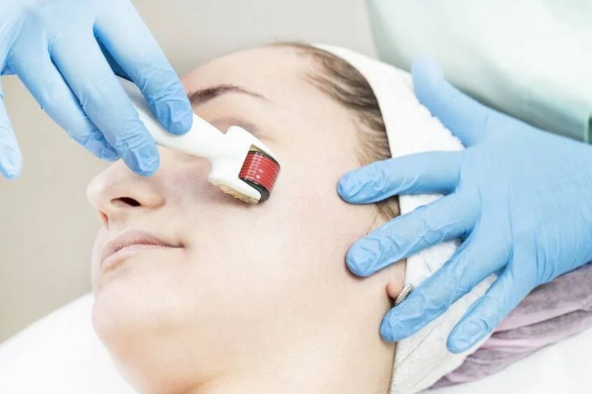 祛痘祛痘印祛斑的方法