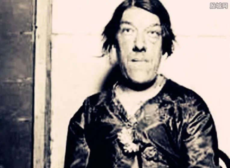 人类历史上九大怪胎四腿女人和独角兽 胆小慎入好可怕