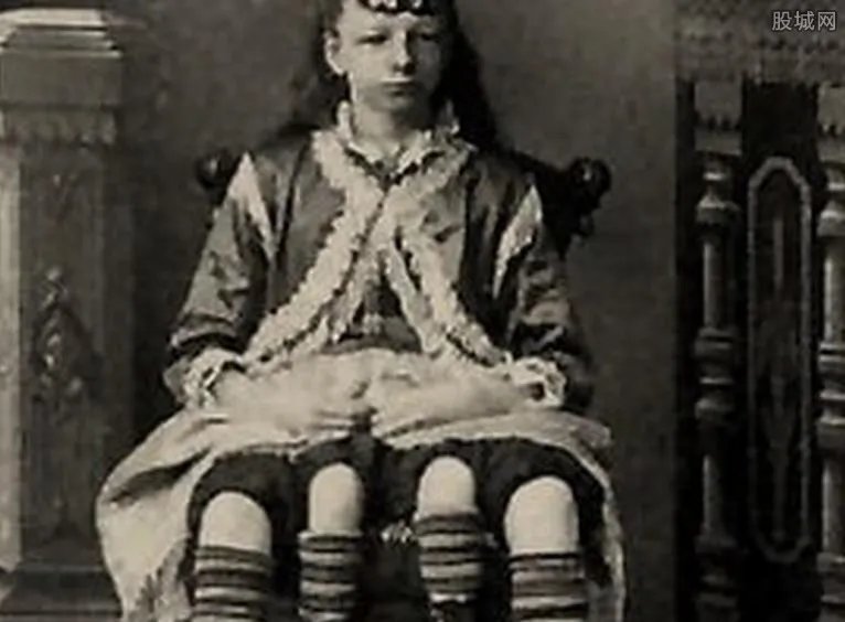 人类历史上九大怪胎四腿女人和独角兽 胆小慎入好可怕