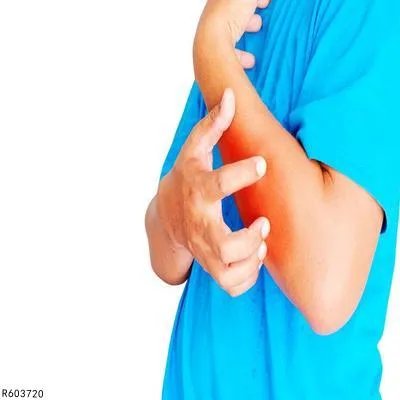 被毛毛虫蛰了怎么治疗