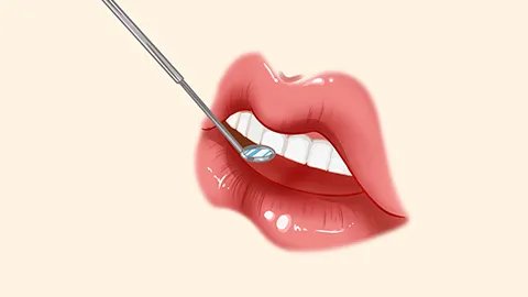 牙科疾病有哪些