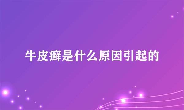 牛皮癣是什么原因引起的