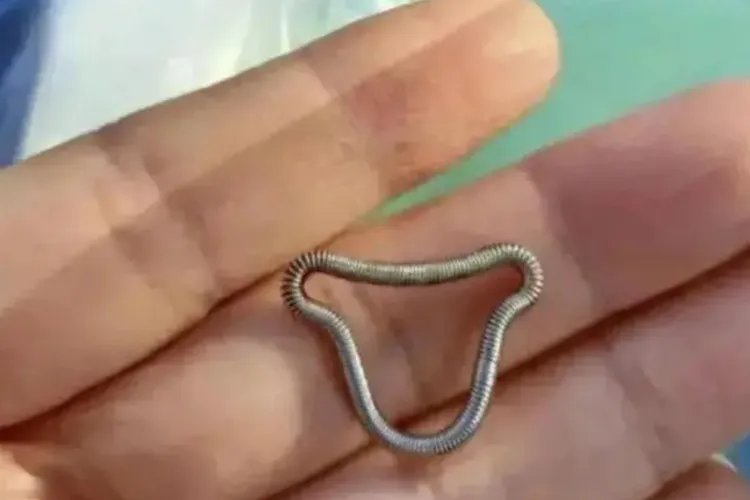 元宫型含铜宫内节育器图片