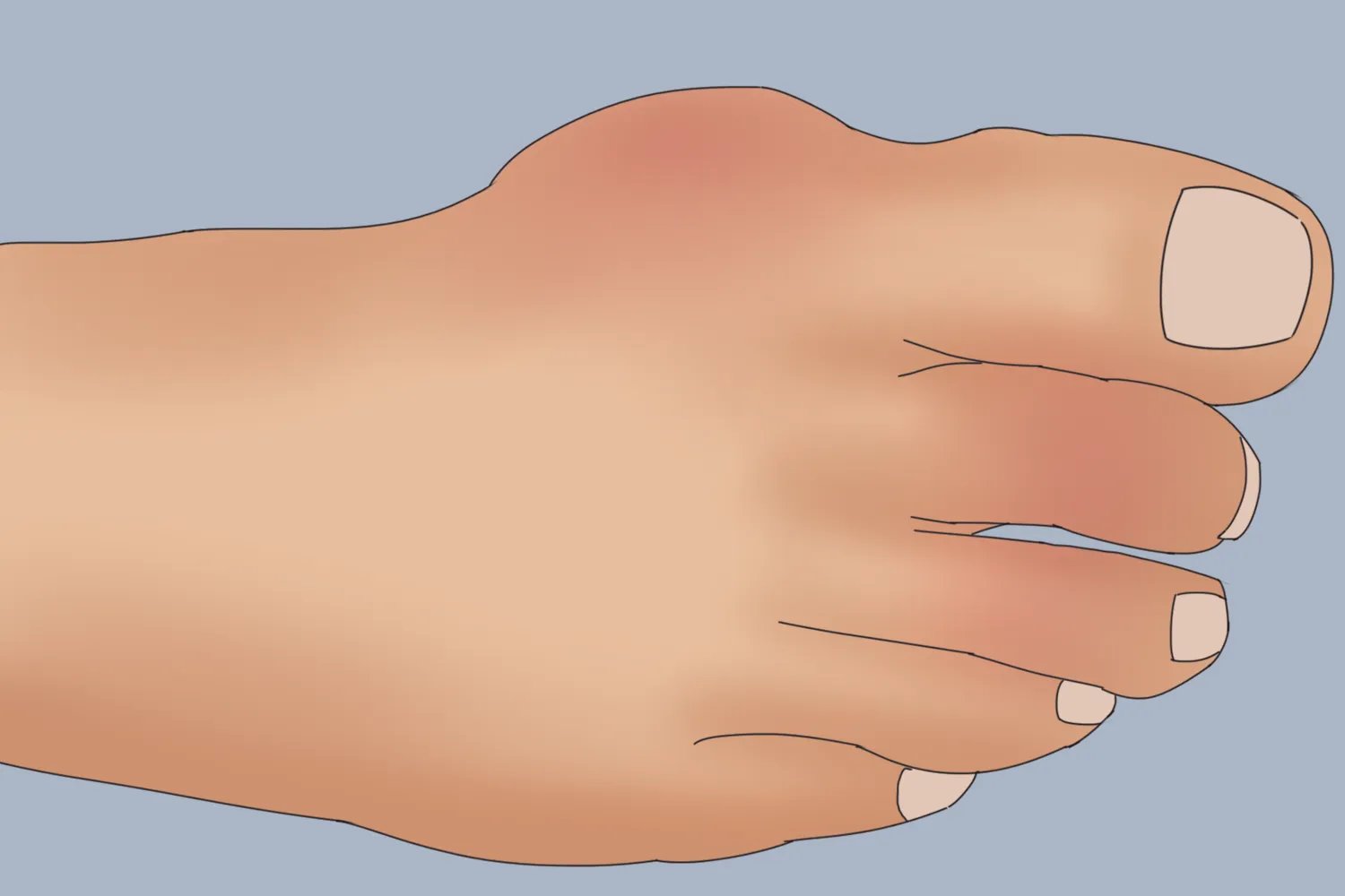 脚痛的位置图片