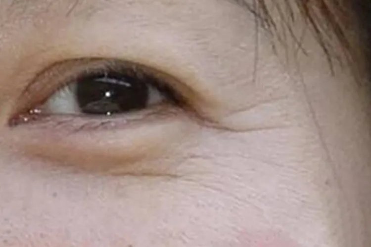 鱼尾纹在哪个位置