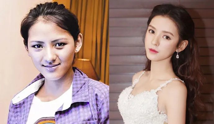 张予曦整容网红前照片 她与王思聪分手走红